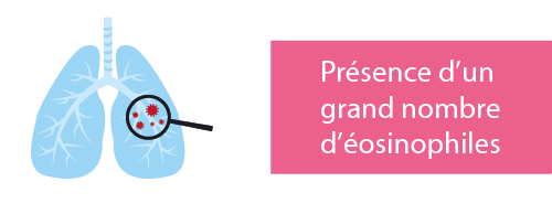 bcp éosinophiles