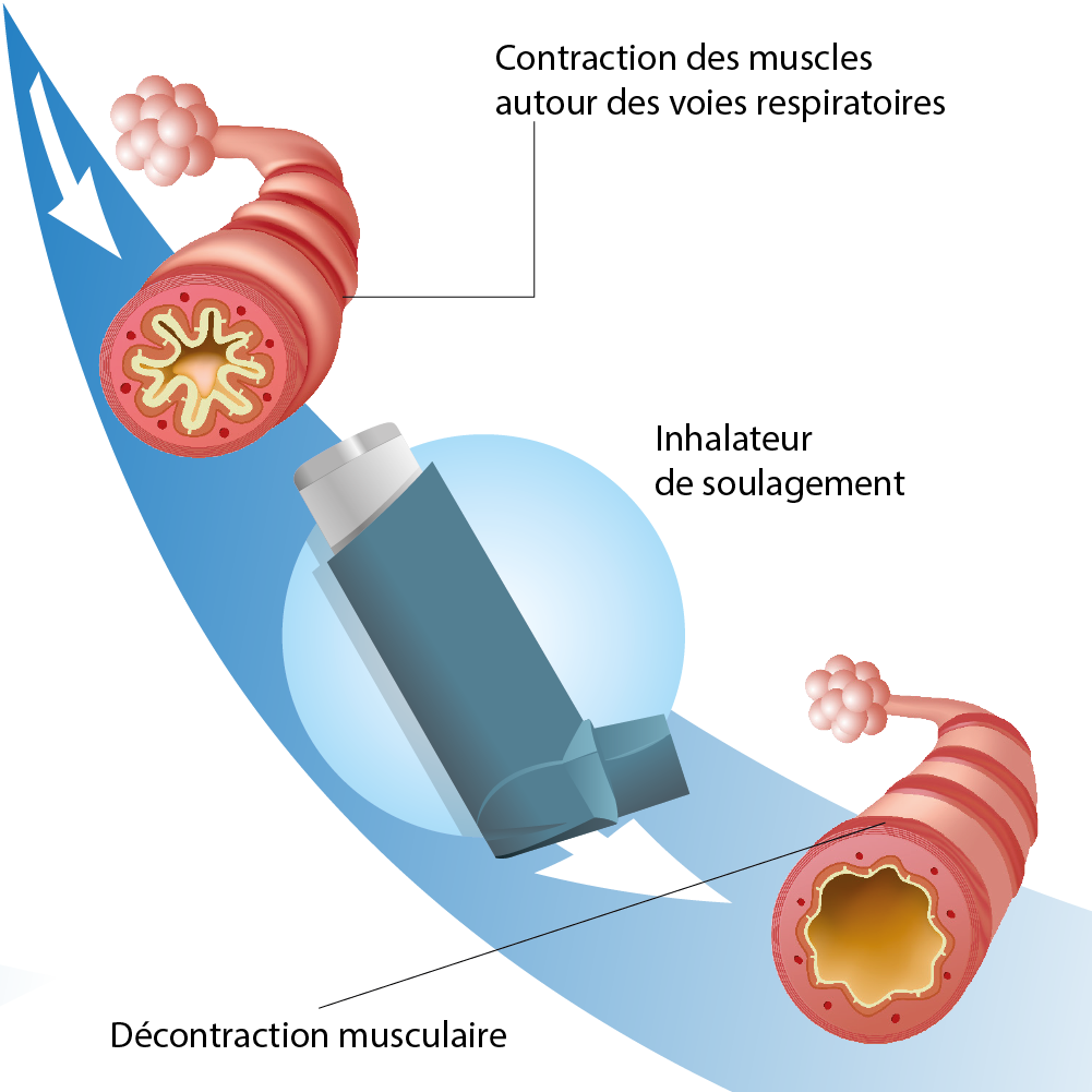 medicaments de secours